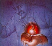 What Research has Taught Us about Curing Heartburn