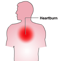 How Can You Get Instant Heartburn Help