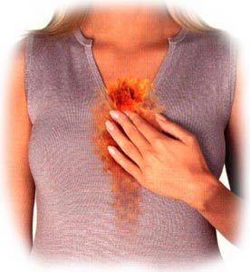 How to Recognize the Signs of Heartburn
